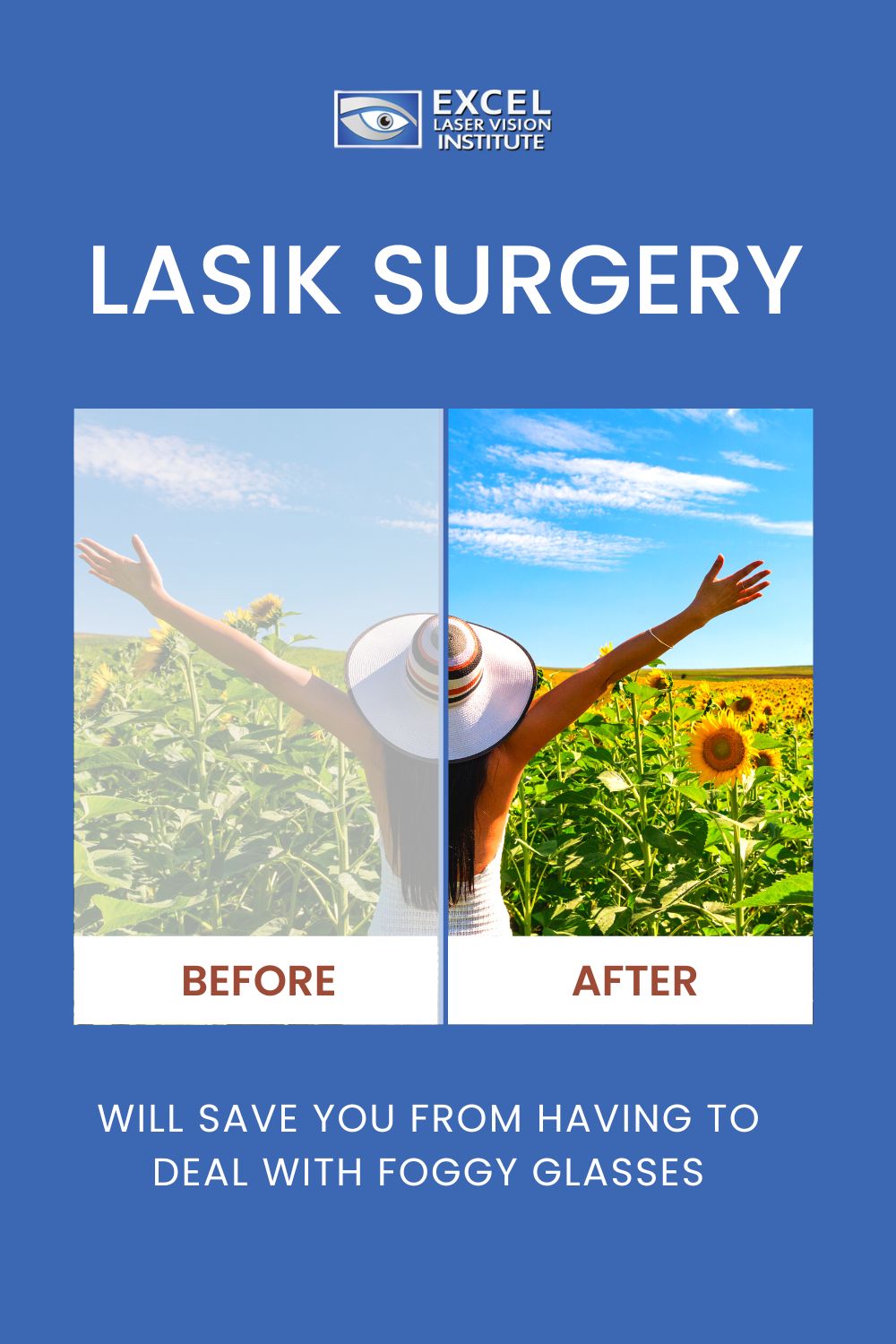 How to Get Rid of Puffy Eyes Will Vision and Lasik Centers