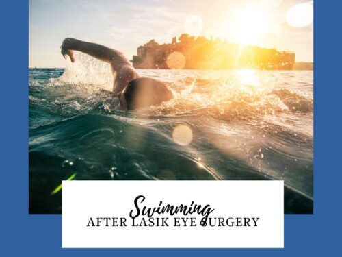Swimming After LASIK