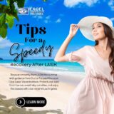 Tips For a Speedy Recovery After LASIK