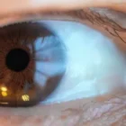 8 Benefits of LASIK for Airline Pilots (and other Demanding Careers)
